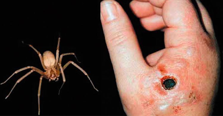 araña-violinista-imagenes